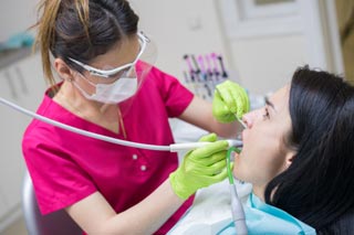 Détartrage chez le dentiste